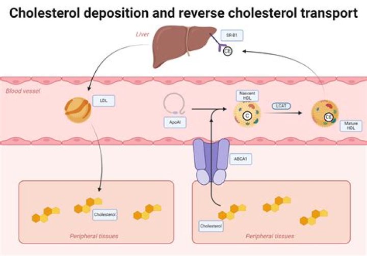 Can Cholesterol be reduced? | ContextResponse.com