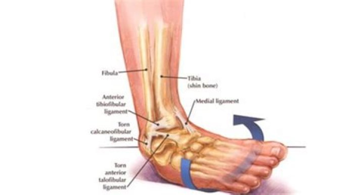Can I break my ankle by rolling it?