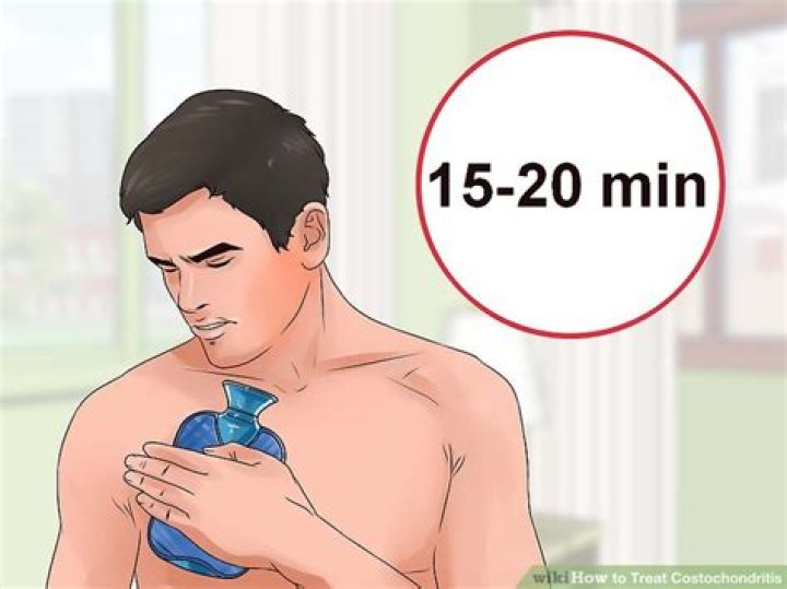 How do doctors treat costochondritis?