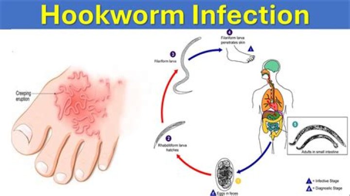 How do they test for hookworms in humans?