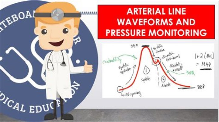 How do you flush an arterial line?