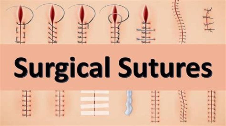 How do you take care of surgical sutures?