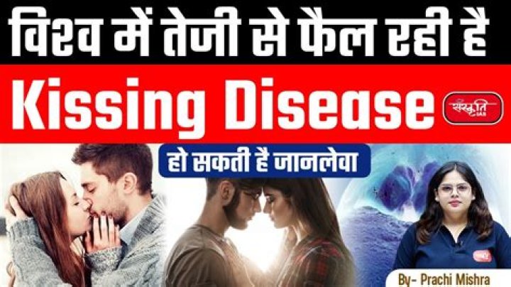 Is asthma contagious through kissing?
