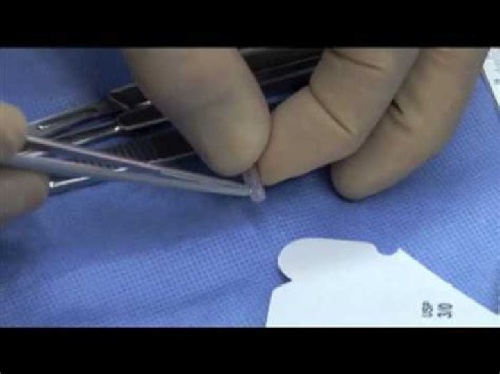 What are Hulka clips made of?