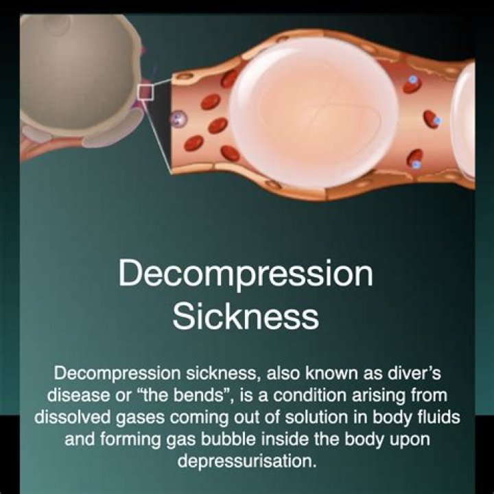What does decompression sickness do?