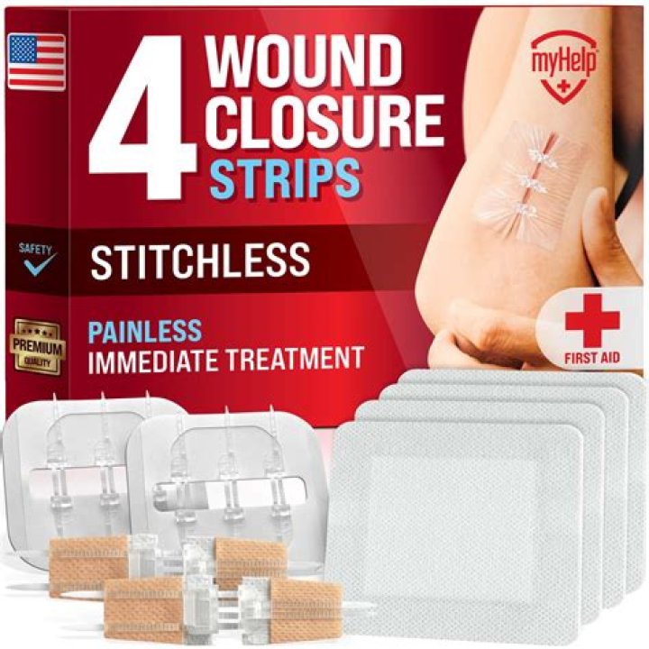 What is a closure block?