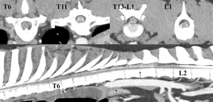 What is a Hemilaminectomy dog?