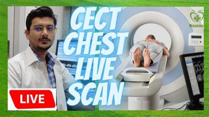 What is CECT thorax test?