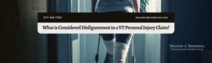 What is considered disfigurement?