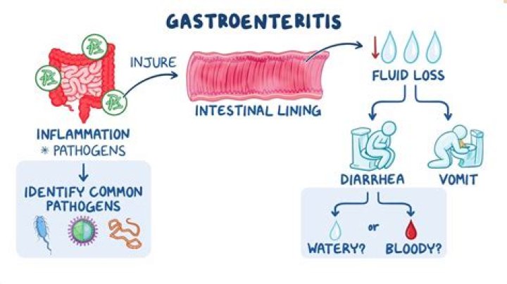 What is enteritis Necroticans? | ContextResponse.com