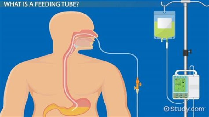 What is high residuals in tube feeding?