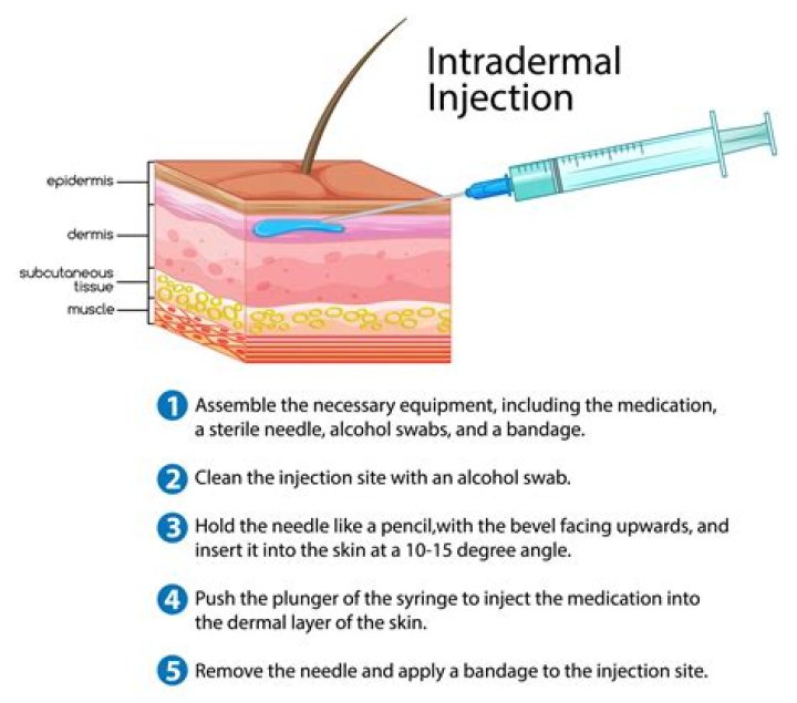 What is intradermal route?
