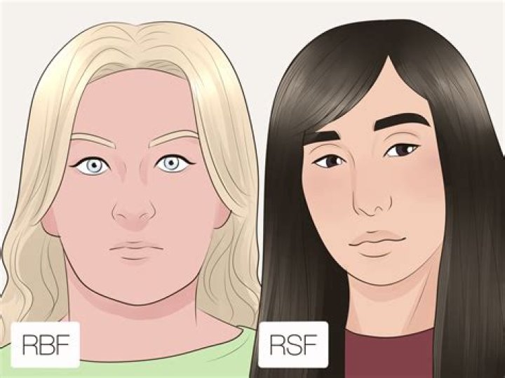 What is resting sad face?