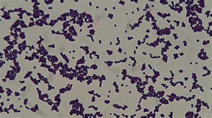 What is the color of Staphylococcus epidermidis?