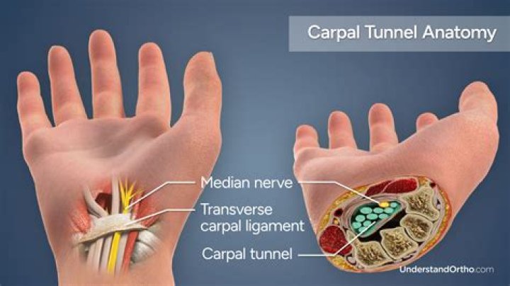 What is the CPT code for carpal tunnel release?