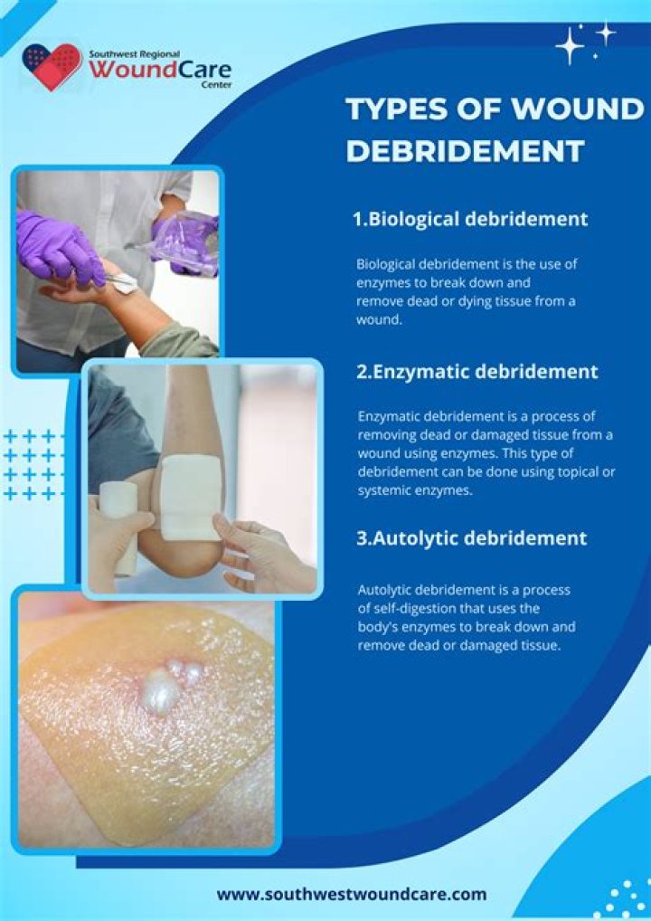 What is the CPT code for debridement of ulcer?