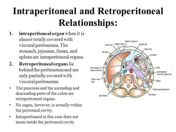 What is the difference between intraperitoneal and retroperitoneal?