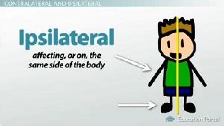 What is the ipsilateral side?