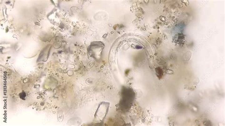 What is the most frequently seen parasite in the urine?