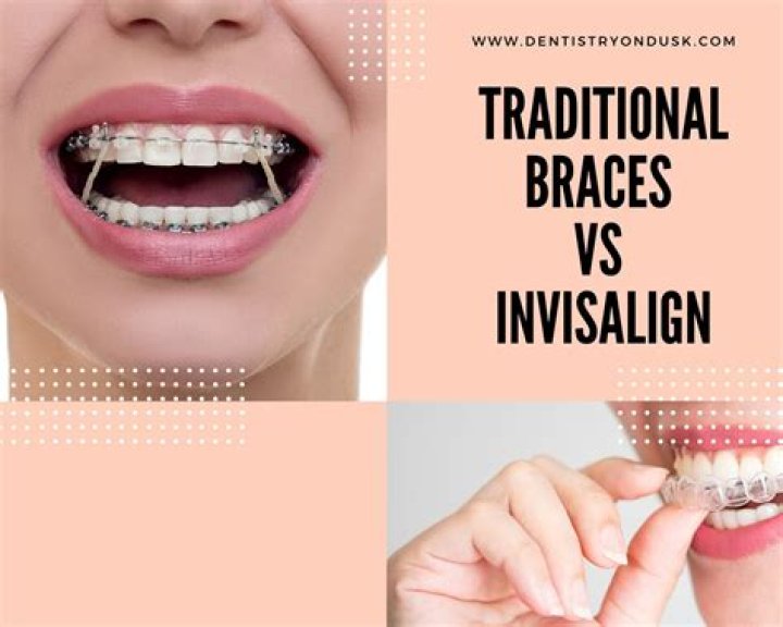 Which is better Invisalign or traditional braces?