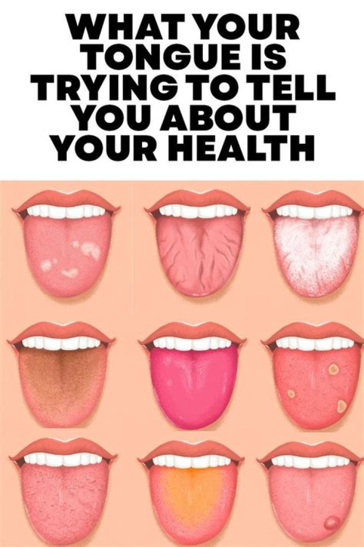 Why is my tongue splitting down the middle?