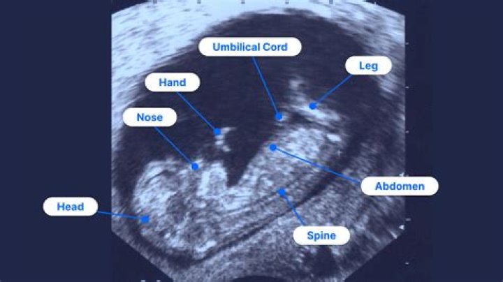 Will the ER do an ultrasound for pregnancy?